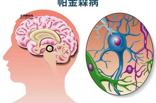 麻痹是什么意思(是神经出了问题吗)