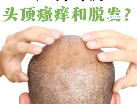 头上著头是什么意思？和头上安头有什么区别