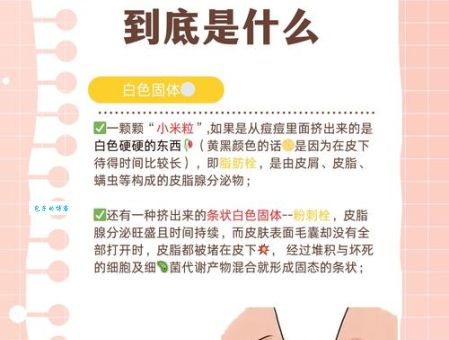 疙里疙瘩是什么意思及例句？快速了解疙里疙瘩的含义