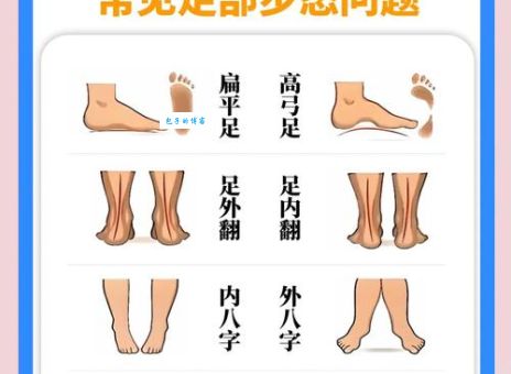 踉踉跄跄什么意思 如何判断自己走路不稳