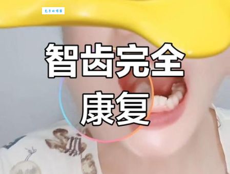 河南拔智齿是什么意思 疼不疼多久能恢复