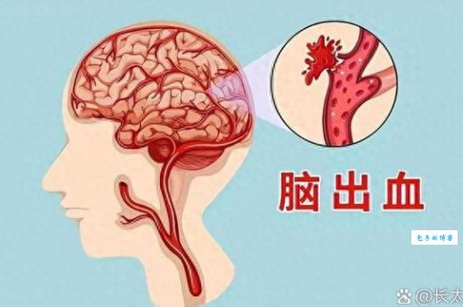 羊髓虽好但哪些人不能吃？这4类人群要注意！