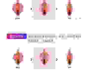 阴齿是什么情况？关于阴齿的常见问题解答来了