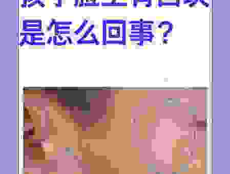 搞懂小白脸到底指什么?这些情况你都知道吗?