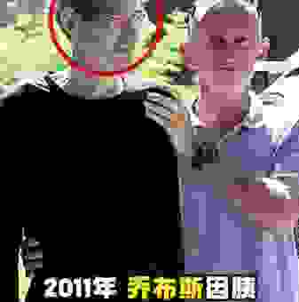 乔布斯去世原因大揭秘，胰腺癌是如何夺走他的生命？