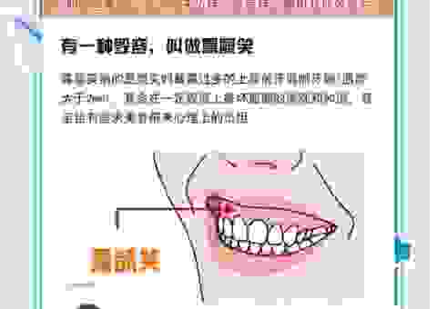 呲牙咧嘴正确答案一肖是哪个？深度分析帮你找规律！