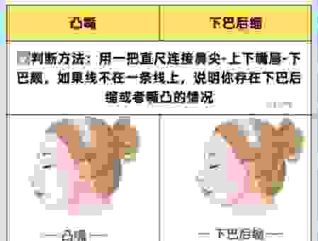 戽斗是什么脸型？改善戽斗脸型的方法有哪些