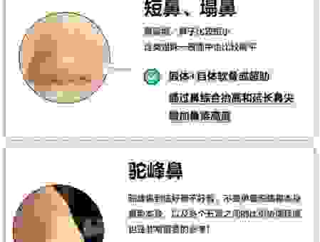 鼻翼宽怎么办快速缩小？教你两个小妙招在家就能做